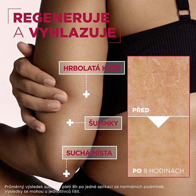 Mixa Regenerating body care for very dry and rough skin Urea Cica Repair+ (Renewing Cream) 150 ml 150ml Moterims