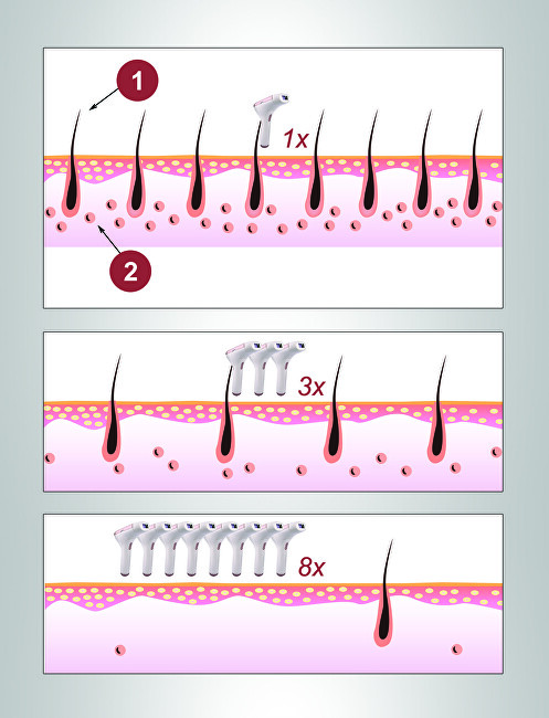 BeautyRelax IPL Premium Epilator BR-1400 depiliavimo prietaisas
