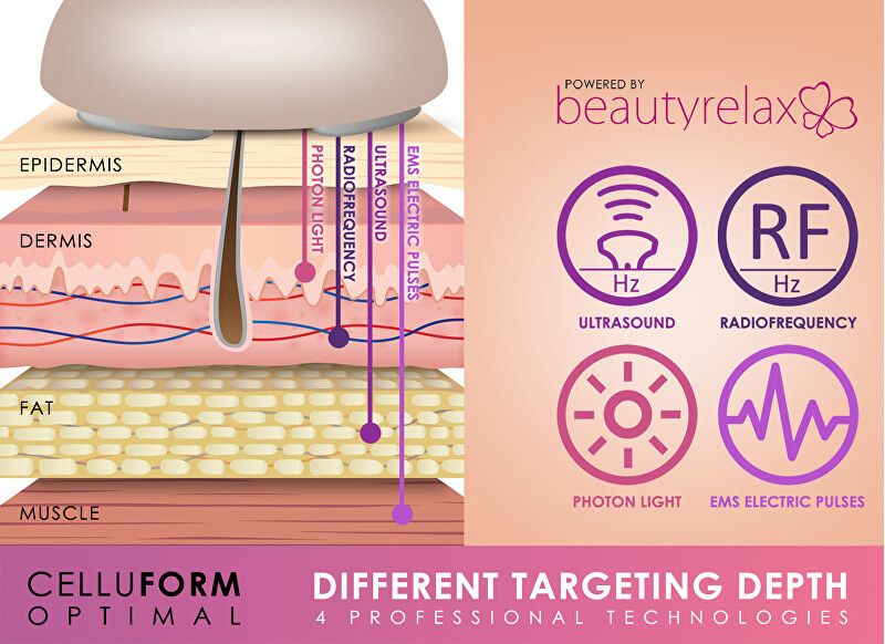 BeautyRelax Beauty Relax Celluform Optimal aesthetic device prietaisas masažui