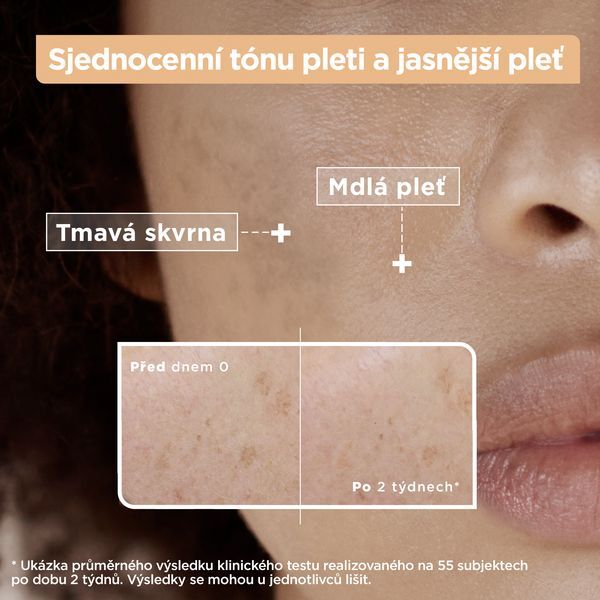 Mixa Serum with vitamin C against pigment spots (Anti-Dark Spot Serum) 30 ml 30ml vietinės priežiūros priemonė