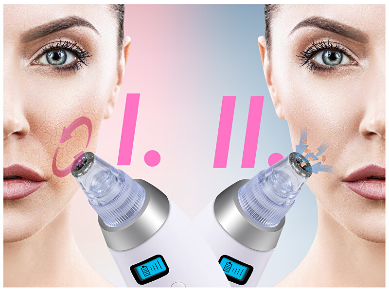 BeautyRelax Cosmetic device for skin abrasion Peelmax makiažo valiklis