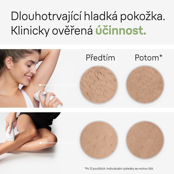 Braun Epilator IPL Silk-expert Pro 3 PL3020 White depiliavimo prietaisas