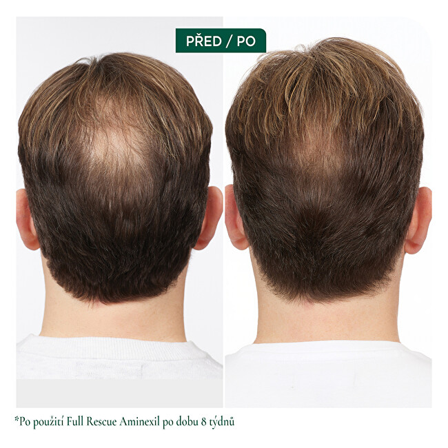 Biolage Intensive treatment against hair loss Full Rescue (Aminexil Treatment) 6 x 10 ml 10ml nenuplaunama plaukų priežiūros priemonė