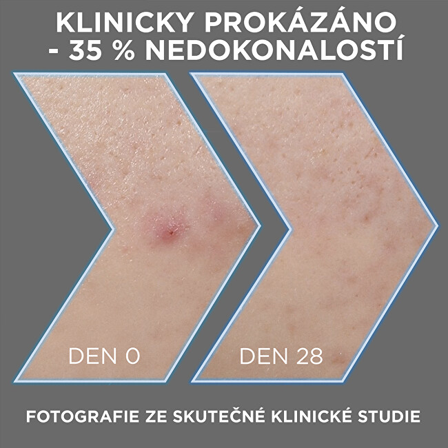 Garnier Serum against skin imperfections AHA + BHA Charcoal (Serum) 30 ml 30ml vietinės priežiūros priemonė