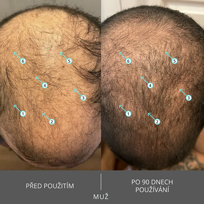 Ds Laboratories Shampoo Extra Strength Hair Density Shampoo 205 ml 205ml &scaron;ampūnas