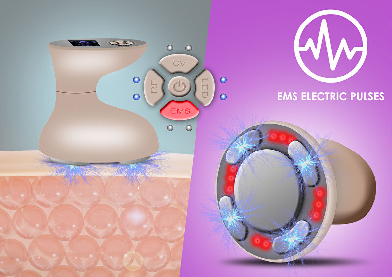 BeautyRelax Beauty Relax Celluform Optimal aesthetic device prietaisas masažui