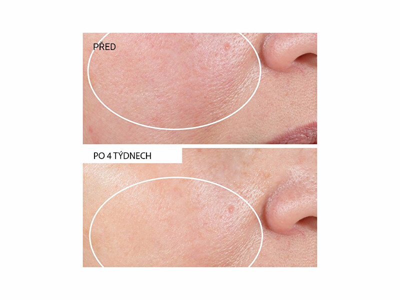 StriVectin Advanced Retinol Nightly Renewal Moisturizer 30ml Dermatoloogiline Öökreem näole thumbnail 13