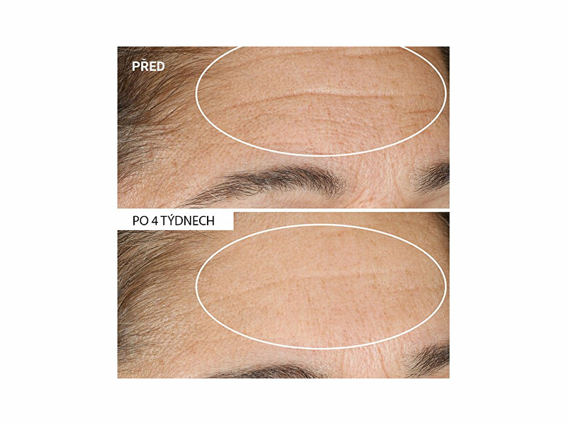 StriVectin Advanced Retinol Nightly Renewal Moisturizer 30ml Dermatoloogiline Öökreem näole thumbnail 12