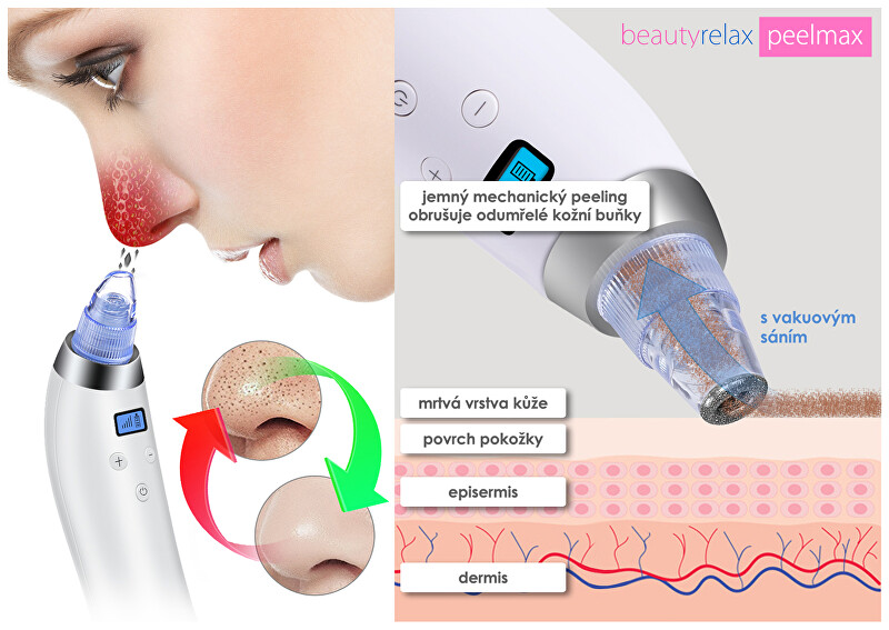 BeautyRelax Cosmetic device for skin abrasion Peelmax makiažo valiklis
