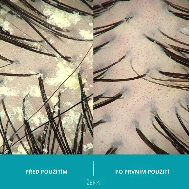 Ds Laboratories Dandrene (Anti-Dandruff Shampoo) 205 ml 205ml &scaron;ampūnas