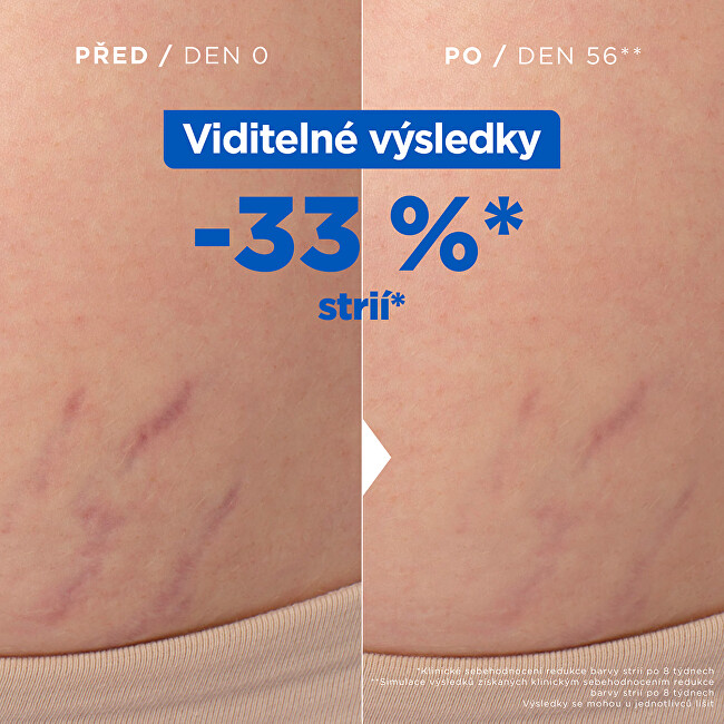 Mixa Oil against stretch marks (Stretch Mark Oil) 100 ml 100ml priemonė celiulitui ir strijoms