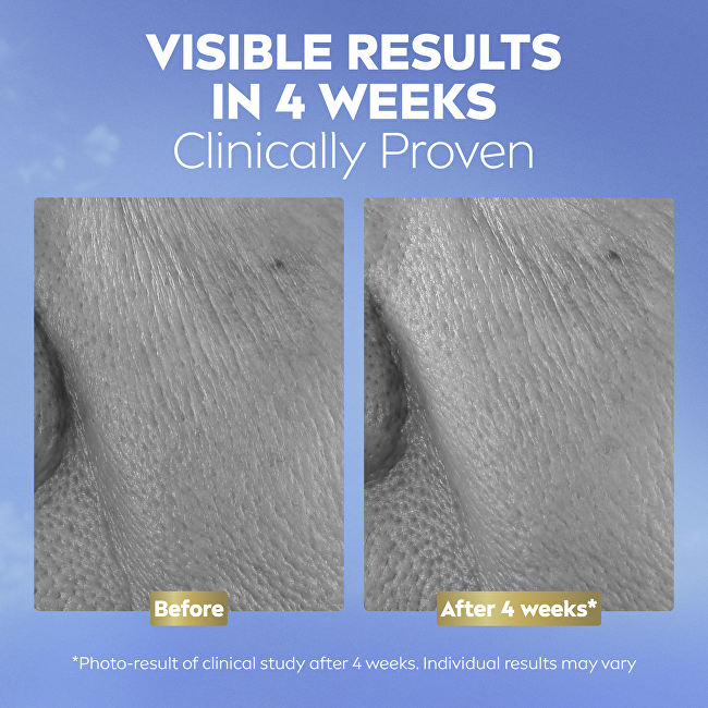 Nivea Anti-wrinkle serum Q10 Repairing Serum 30 ml 30ml vietinės priežiūros priemonė