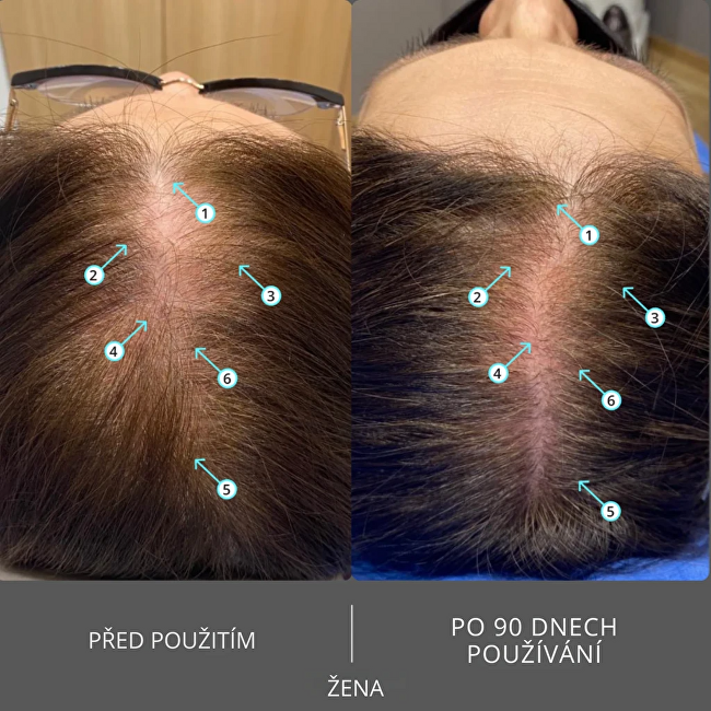 Ds Laboratories Shampoo Extra Strength Hair Density Shampoo 205 ml 205ml &scaron;ampūnas