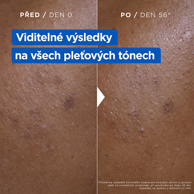 Mixa Moisturizing Anti-Dark Spot Cream 400ml vietinės priežiūros priemonė