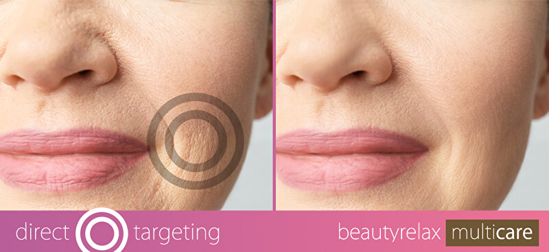 BeautyRelax Cosmetic device Multicare BR-1380 veido valymo prietaisas