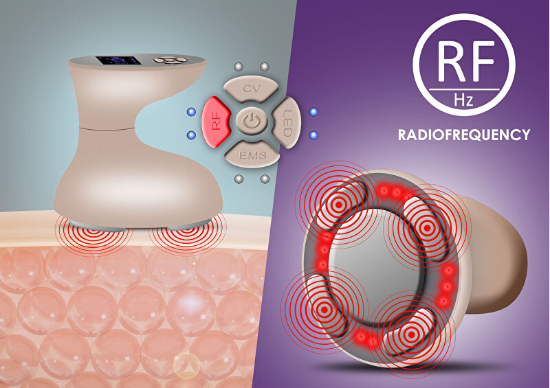 BeautyRelax Beauty Relax Celluform Optimal aesthetic device prietaisas masažui