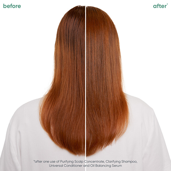 Biolage Scalp Sync oil balancing serum (Oil Balancing Serum) 50 ml 50ml nenuplaunama plaukų priežiūros priemonė