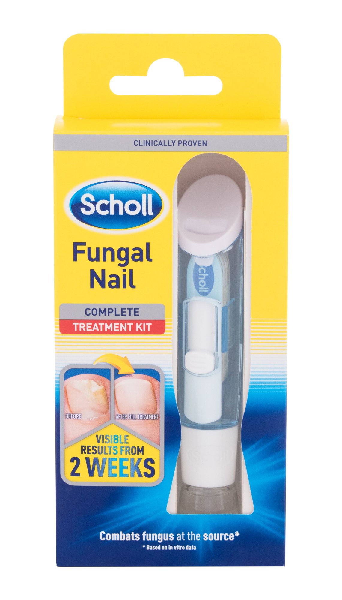 Scholl Fungal Nail Complete Treatment nagų priežiūrai